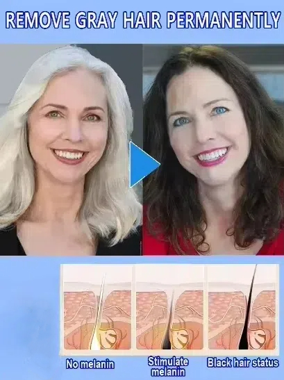 White hair killer, remove gray - Hair Care Natural Products recension och pris