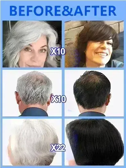 White hair killer, remove gray - Hair Care Natural Products recension och pris