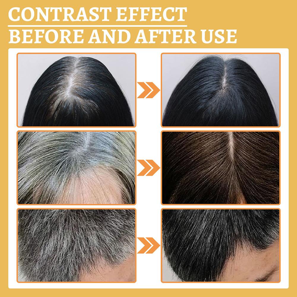 1/2PCS Hair Growth Serum Oil,  - Hair Care Natural Products recension och pris