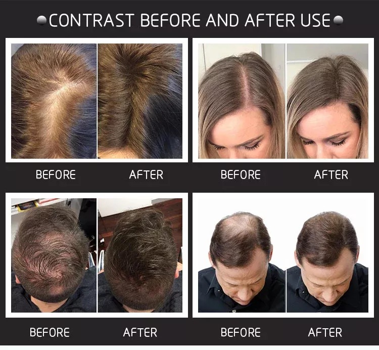 28g Hair Building Fibers Come  - Hair Care Natural Products recension och pris