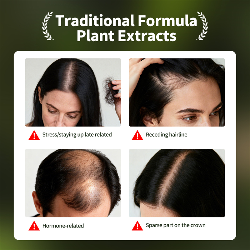 Natural Hair Growth Set Usman  - Hair Care Natural Products recension och pris